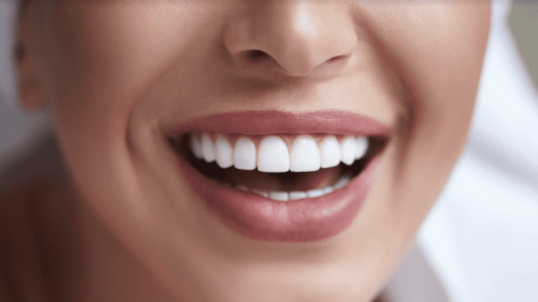Women smiling after cosmetic dentistry, Garran ACT