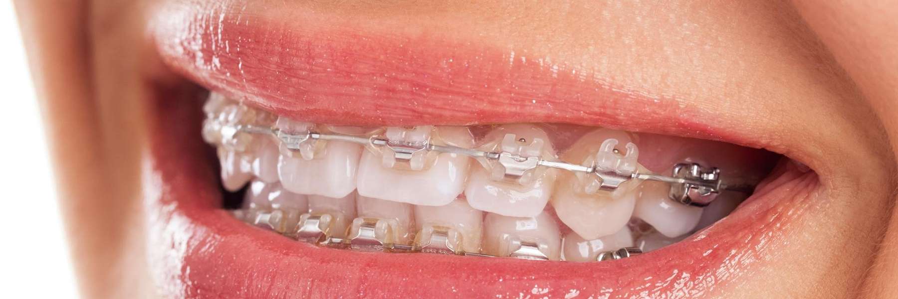 How Cosmetic Dentistry Can Improve Your Oral Health