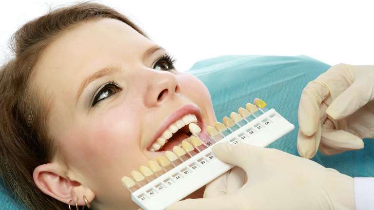 Teeth Whitening