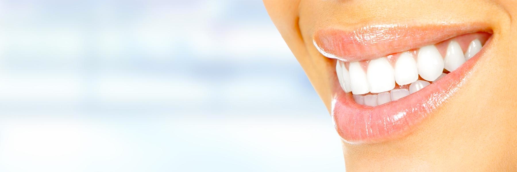 Womans smile with white teeth in Garran 
