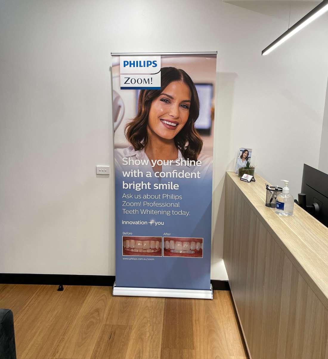 Teeth whitening promotion in Garran and Woden